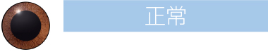 正常